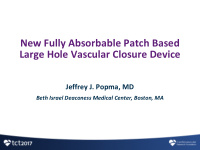 large hole vascular closure device