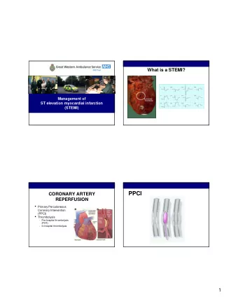 PPCI  CORONARY ARTERY  REPERFUSION  Primary Percutaneous  Coronary Intervention  (PPCI)