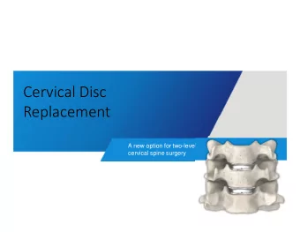 Cervical Disc  Replacement  A new option for two-level  cervical spine surgery  Darrell C. Brett,