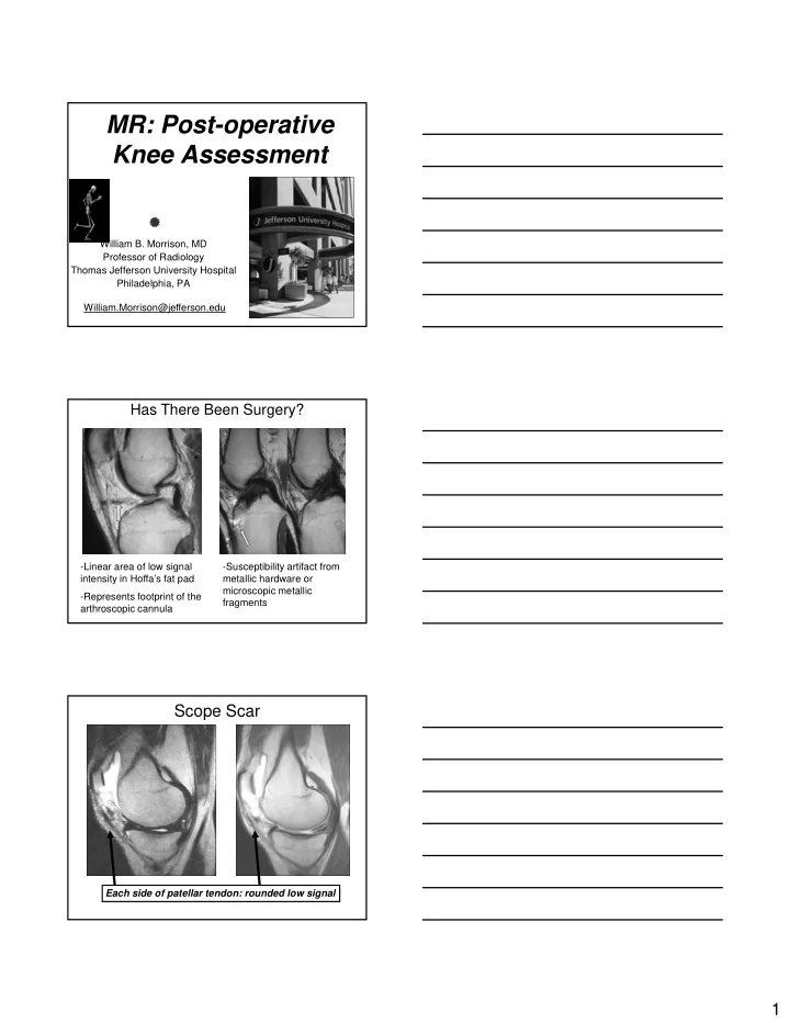 mr post operative knee assessment