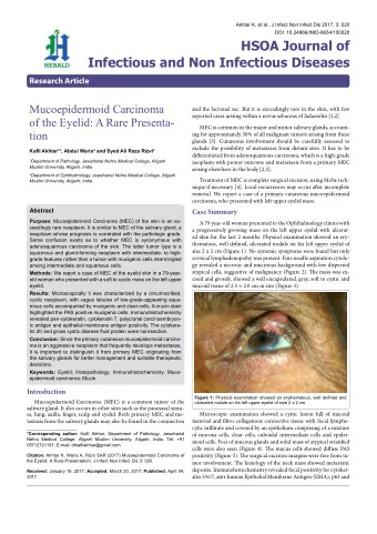 Mucoepidermoid Carcinoma  and the lacrimal sac. But it is exceedingly rare in the skin, with few