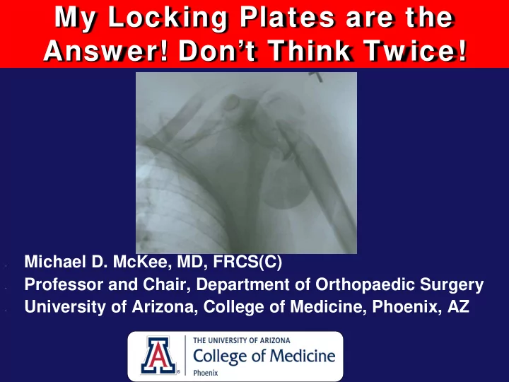 my locking plates are the answ er don t think tw ice
