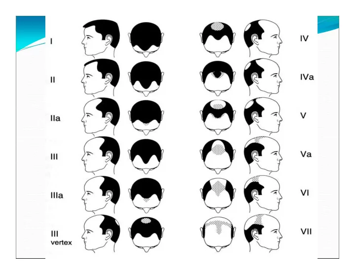 various factors causing hair loss apart from androgenic