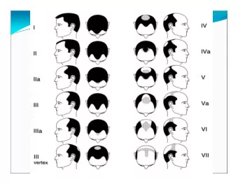 Various Factors causing Hair loss apart from Androgenic Alopecia  External factors