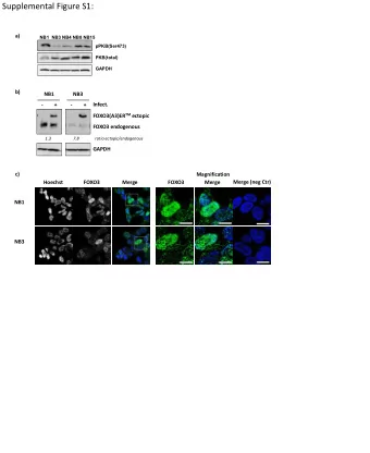 Supplemental Figure S1:  a)  NB1  NB3 NB4 NB8 NB15  pPKB(Ser473)  PKB(total)  GAPDH  b) NB1 NB3