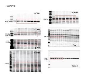 Figure 1B  tubulin  STIM1  50kDa  80kDa  STIM2  100kDa  80kDa  50kDa  50kDa  Orai1  pJNK  pCamK