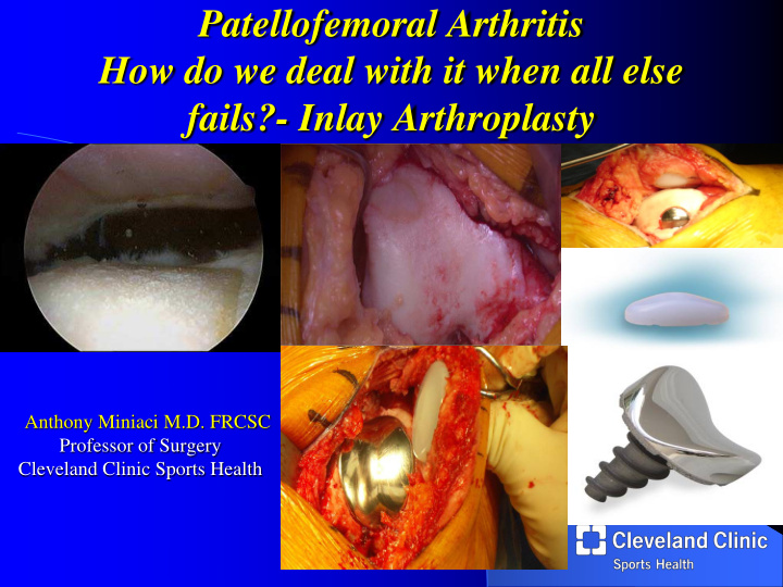 patellofemoral arthritis how do we deal with it when all