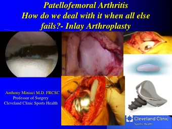 Patellofemoral Arthritis  How do we deal with it when all else  fails?- Inlay Arthroplasty  Anthony