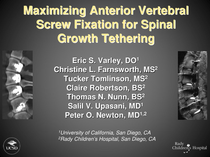 maximizing anterior vertebral maximizing anterior