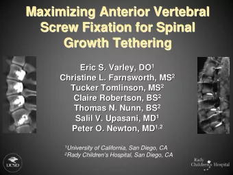 Maximizing Anterior Vertebral  Maximizing Anterior Vertebral  Screw Fixation for Spinal  Screw
