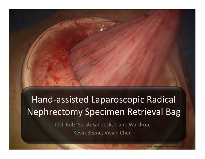 hand assisted laparoscopic radical nephrectomy specimen