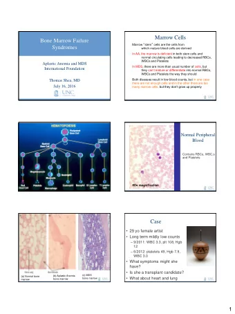 Marrow Cells  Bone Marrow Failure Marrow  stem  cells are the cells from  Syndromes  which