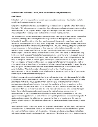 Pulmonary adenocarcinoma  Issues, Issues and more issues. Why the headache?  Alain Borczuk  In