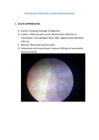 PATHOLOGY PRACTICAL SLIDES IDENTIFICATION 1. ACUTE APPENDICITIS: A. Section showing histology of