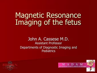 Imaging of the fetus  John A. Cassese M.D.  Assistant Professor  Departments of Diagnostic Imaging