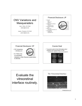 Evaluate the  vitreoretinal  interface routinely.  retinalphysician.com  1  Anomalous PVD