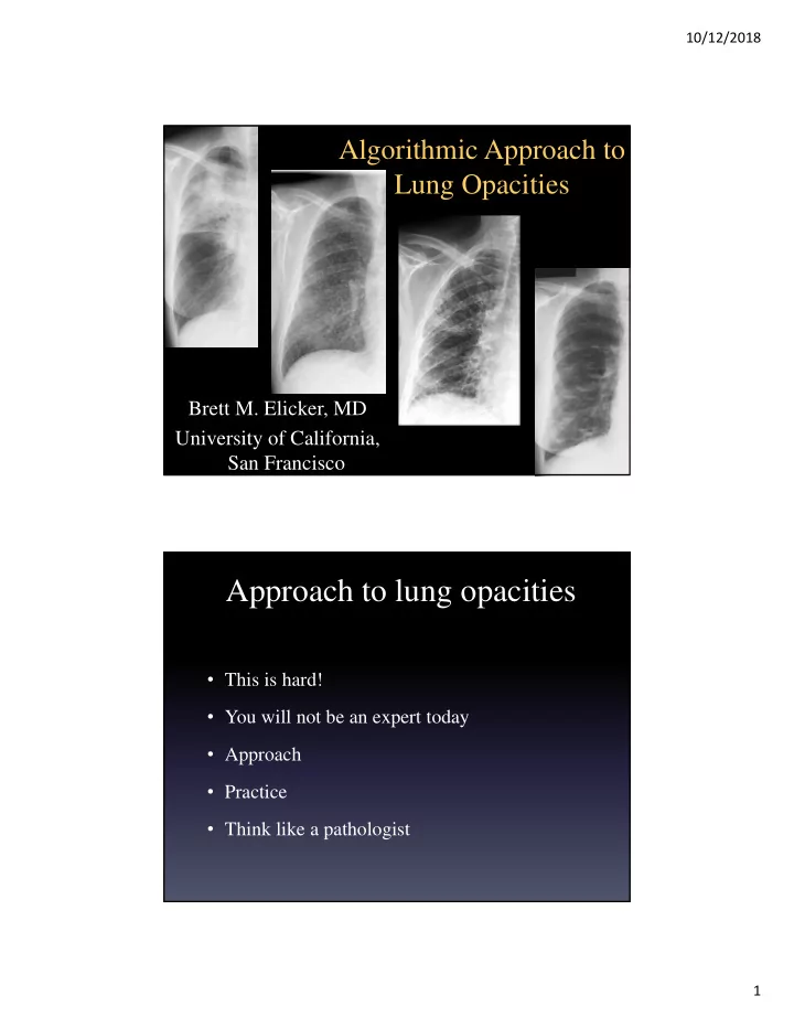 approach to lung opacities