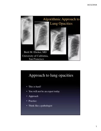 Approach to lung opacities  This is hard!  You will not be an expert today  Approach