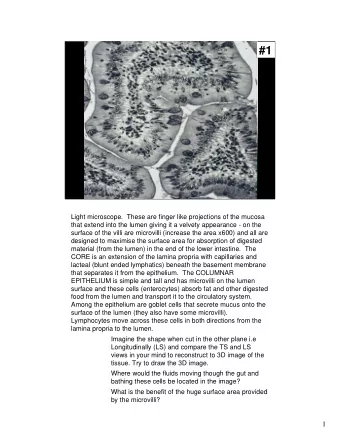 #1  Light microscope.  These are finger like projections of the mucosa  that extend into the lumen