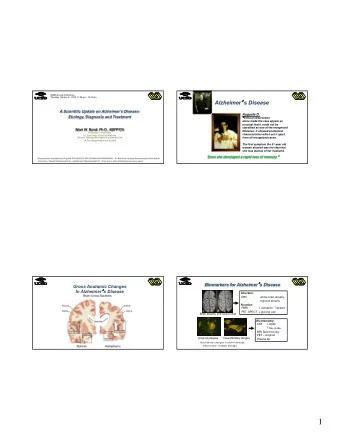 1  MCI Criteria  Two Contrasting Theories of  Incorporating Biomarkers  Alzheimers Disease