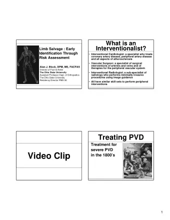 Video Clip  in the 1800s  1  Treating PVD  Treating PVD  Treatment  for severe  Despite