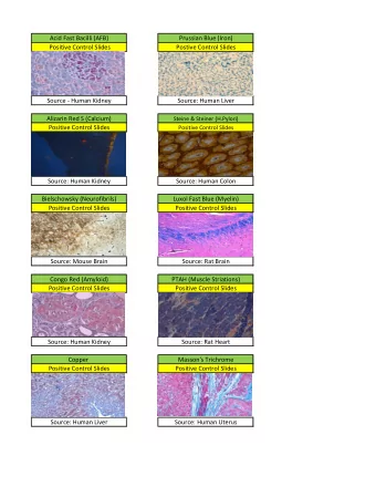 Acid Fast Bacilli (AFB)  Prussian Blue (Iron)  Positive Control Slides  Postive Control Slides