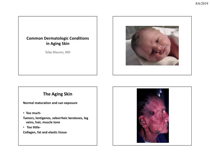 the aging skin