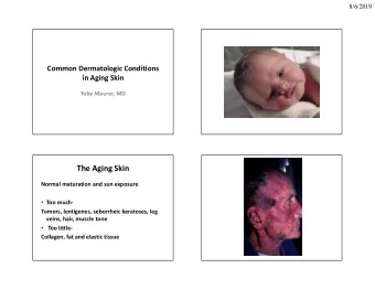 The Aging Skin  Normal maturation and sun exposure  Too much-  Tumors, lentigenes, seborrheic