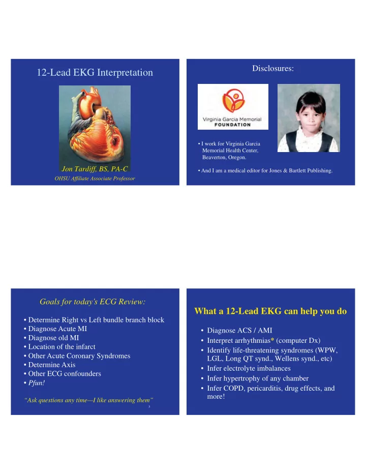 12 lead ekg interpretation