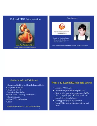 12-Lead EKG Interpretation   I work for Virginia Garcia  Memorial Health Center,