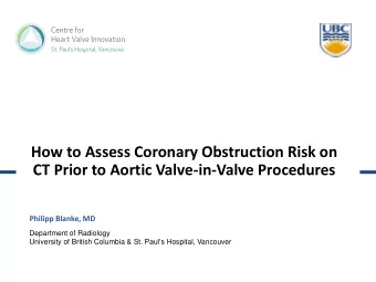 How to Assess Coronary Obstruction Risk on  CT Prior to Aortic Valve-in-Valve Procedures  Philipp