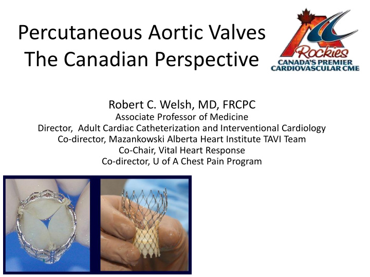 percutaneous aortic valves the canadian perspective