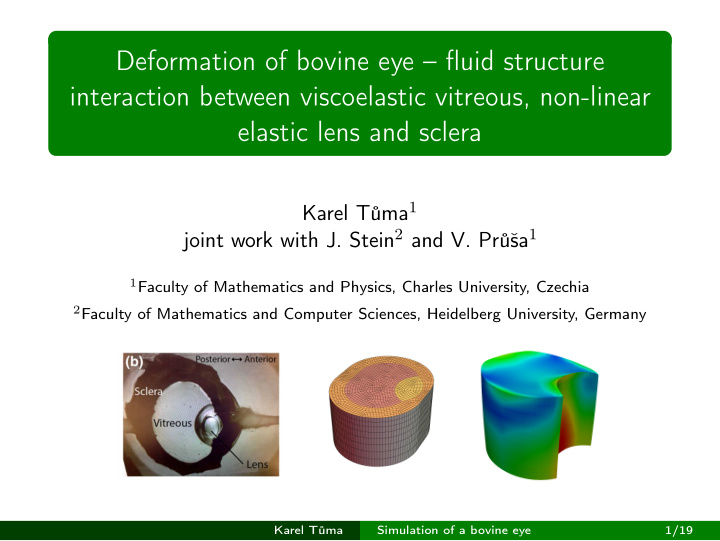 deformation of bovine eye fluid structure interaction