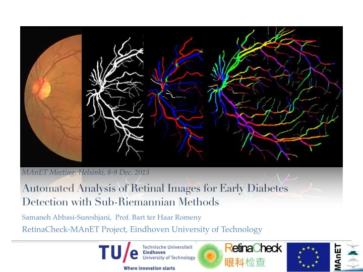 automated analysis of retinal images for early diabetes