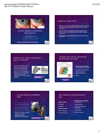 LEARNING OBJECTIVES  1. W  hy doesnt Ehlers-Danlos Syndrome(EDS) present more often  with high m