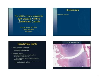 Disclosures  I have nothing to disclose.  The ABCs of non-neoplastic  joint disease: Arthritis,
