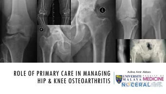 HIP &amp; KNEE OSTEOARTHRITIS  Faculty of Medicine, University  of Malaya  Most common cause of