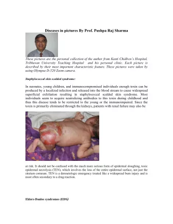 Diseases in pictures By Prof. Pushpa Raj Sharma  These pictures are the personal collection of the
