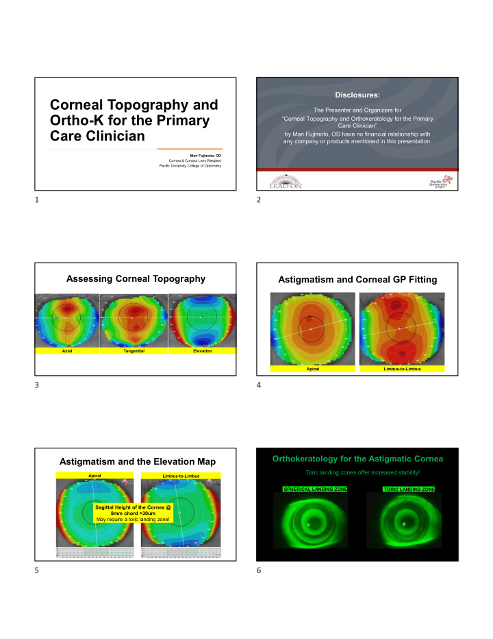 corneal topography and
