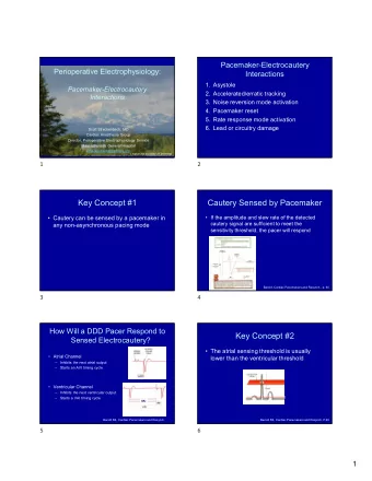 Key Concept #1  Cautery Sensed by Pacemaker   Cautery can be sensed by a pacemaker in   If