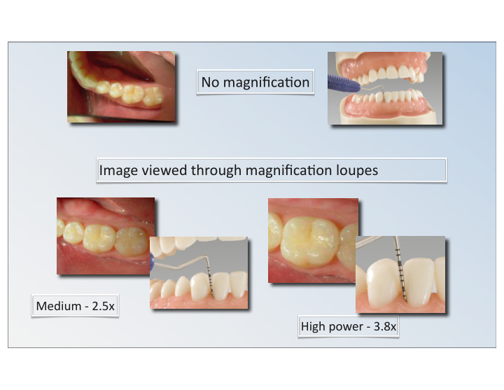 no magnifica on image viewed through magnifica on loupes