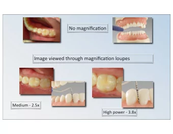 No  magnifica=on    Image  viewed  through  magnifica=on  loupes  Medium