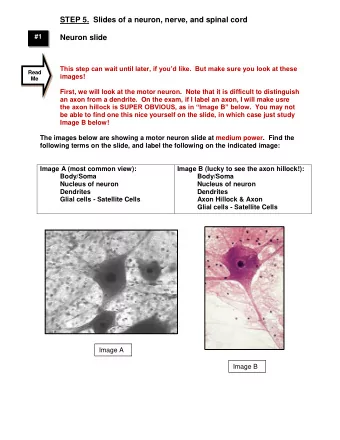 STEP 5.  Slides of a neuron, nerve, and spinal cord  #1  Neuron slide  This step can wait until