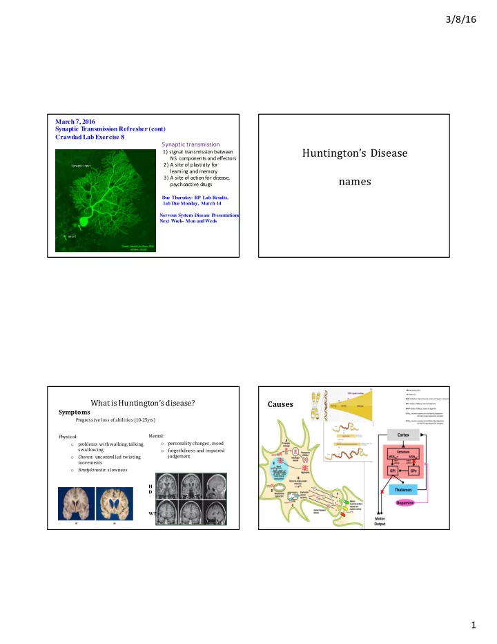 huntington s disease