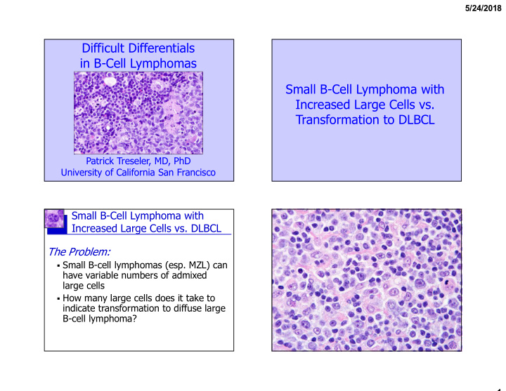 difficult differentials in b cell lymphomas small b cell