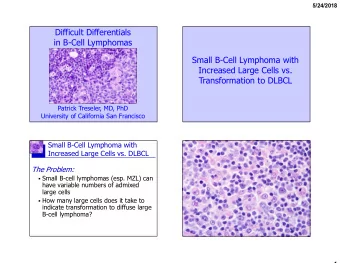 Difficult Differentials  in B-Cell Lymphomas  Small B-Cell Lymphoma with  Increased Large Cells vs.