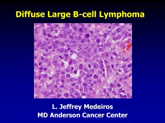 Diffuse Large B-cell Lymphoma  L. Jeffrey Medeiros  MD Anderson Cancer Center Outline  Introduction