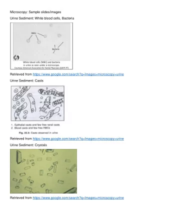 Microscopy: Sample slides/images  Urine Sediment: White blood cells, Bacteria  Retrieved from