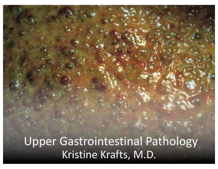 upper gastrointestinal pathology