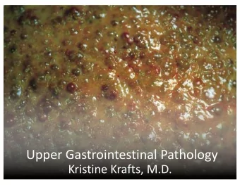 Upper Gastrointestinal Pathology  Kristine Krafts, M.D.  GI Pathology Outline  Esophagus